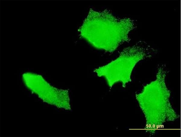 APC Antibody (clone 3E2)