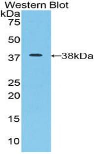 ICA69 / ICA1 Antibody (aa1-258)