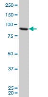 TARS Antibody (clone 1A9)