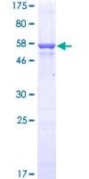 Human QPRT Protein (Recombinant GST)
