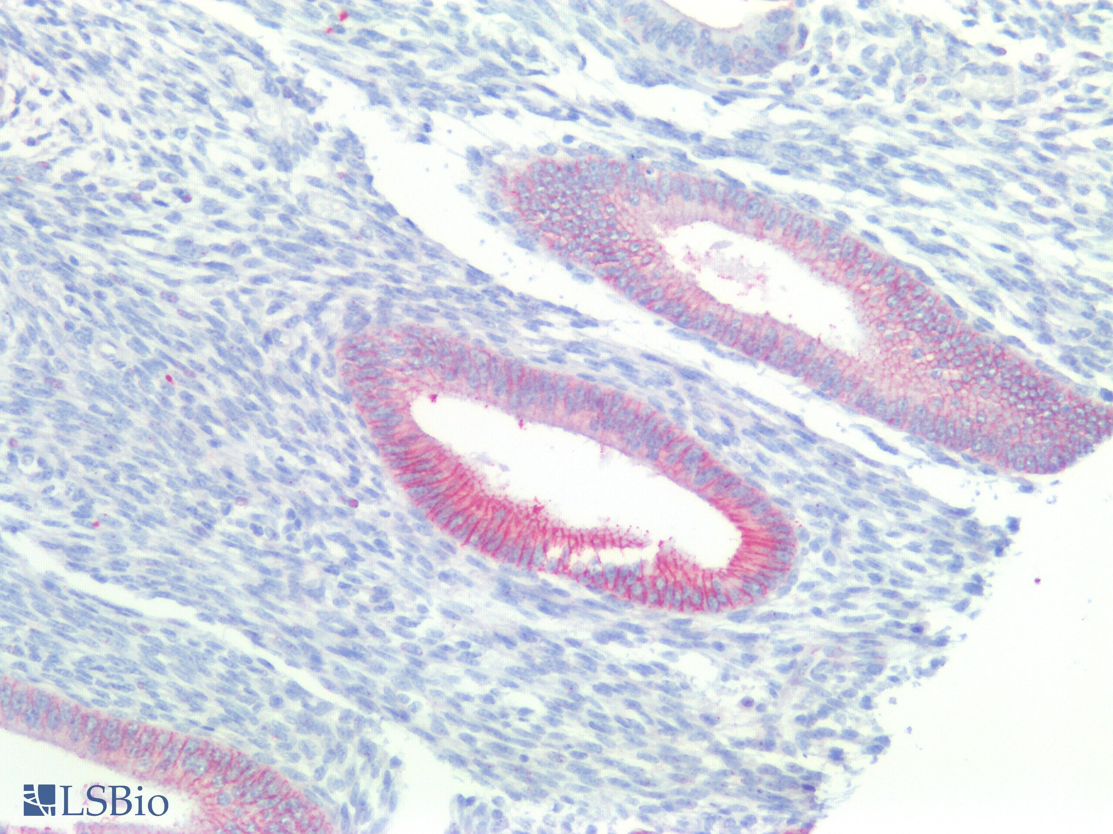 IHC-plus™ Polyclonal Rabbit anti-Human CTNNB1 / Beta Catenin Antibody (N-Terminus, IHC, WB)