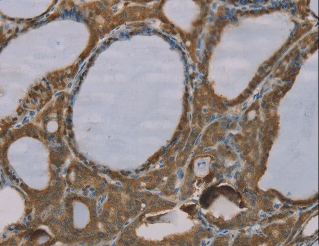 S100A6 / Calcyclin Antibody