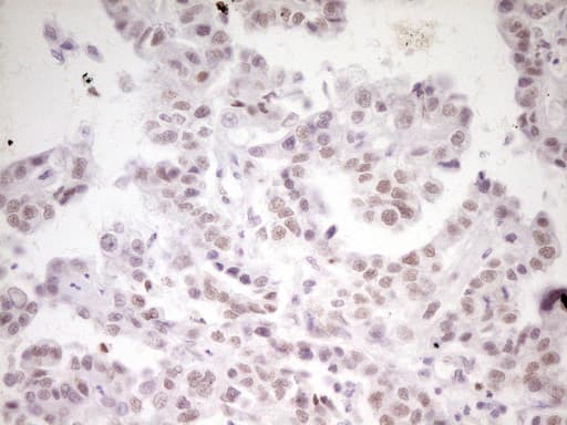 Monoclonal Mouse anti-Human HMG20A Antibody (clone OTI2H4, Carrier-free, aa1-281, IHC, WB)