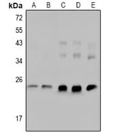 TNNI3 / Cardiac Troponin I Antibody