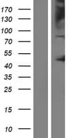 Human OCA2 / P protein (Over-Expression Lysate Myc-DDK (Flag))