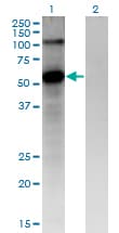 Monoclonal Mouse anti-Human FZD4 / Frizzled 4 Antibody (clone 3G7, WB)