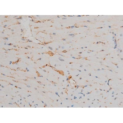 AP-1 / JUND Antibody (phospho-Ser255)