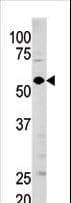GUCY1A1 / GUCY1A3 Antibody (aa269-300)