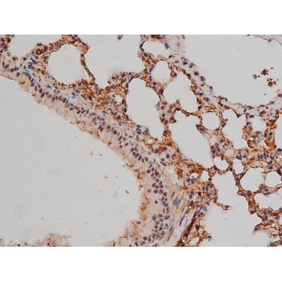 SP1 Antibody (phospho-Thr453)