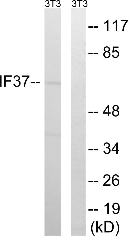 IHC-plus™ EIF3D Antibody (aa101-150)