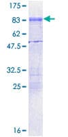 Human CPEB1 / CPEB Protein (Recombinant GST)