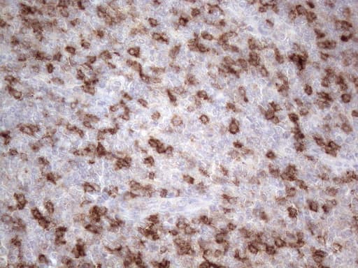 Monoclonal Mouse anti-Human PDCD1 / CD279 / PD-1 Antibody (clone OTI2D10, IHC, WB)