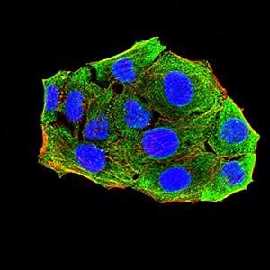 ADAM8 Antibody (clone 3B10D7)