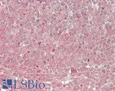 IHC-plus™ p16INK4a / CDKN2A Antibody