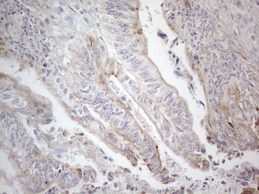 Monoclonal Mouse anti-Human HGF / Hepatocyte Growth Factor Antibody (clone OTI1D2, aa200-494, IHC, WB)