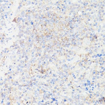 Polyclonal Rabbit anti-Human IGFBP1 Antibody (IHC, WB)