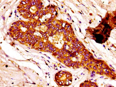 FASN / Fatty Acid Synthase Antibody (aa2155-2495)