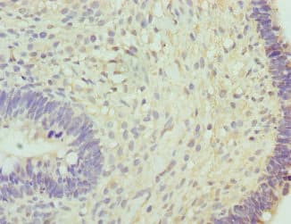 Polyclonal Rabbit anti-Human RNGTT / HCAP Antibody (IHC, WB)