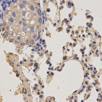 NEK8 Antibody