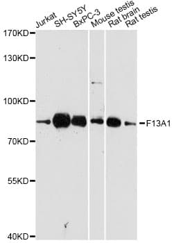 F13A1 / Factor XIIIa Antibody