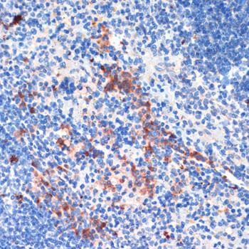 LRRK2 Antibody