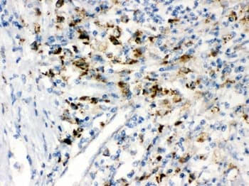 PPT1 / CLN1 Antibody