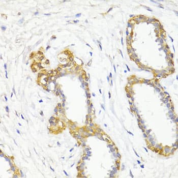 Polyclonal Rabbit anti-Human MAP1LC3B / LC3B Antibody (IHC, IF, WB)