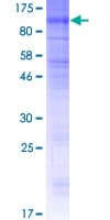 Human SLCO4C1 Protein (Recombinant GST)