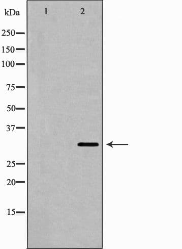 Polyclonal Rabbit anti-Human FASLG / Fas Ligand Antibody (IHC, WB)