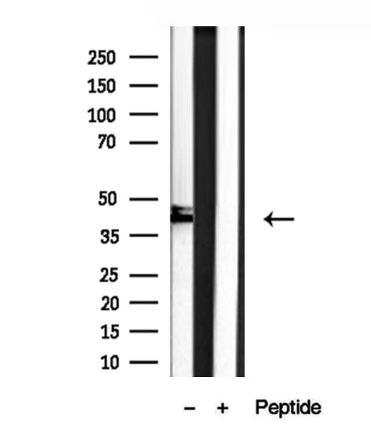 SHARPIN Antibody
