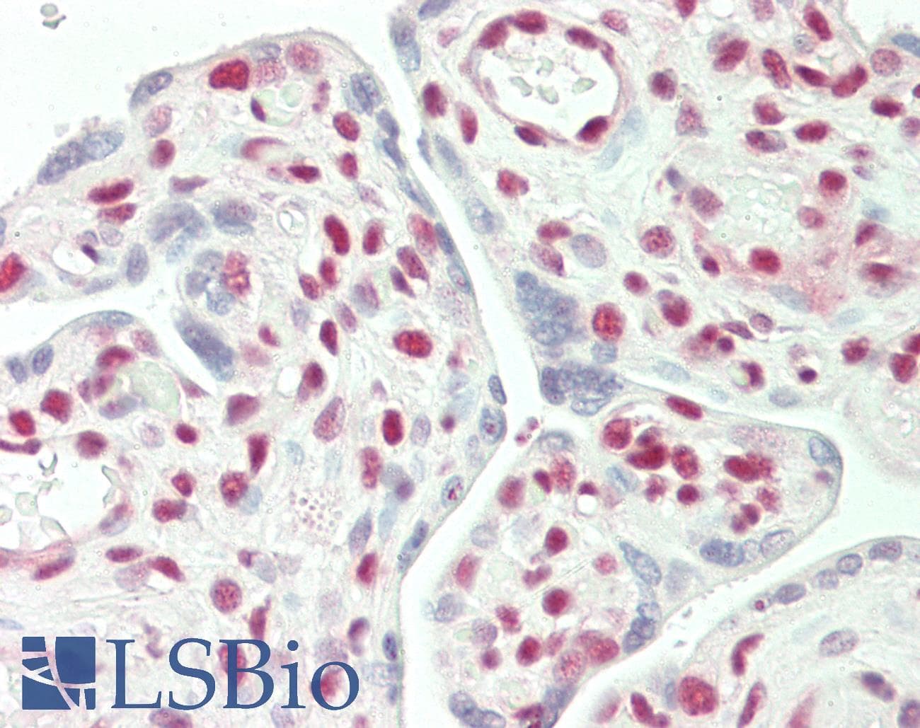 IHC-plus™ Polyclonal Goat anti-Human STAG2 Antibody (aa1100-1150, IHC, WB)