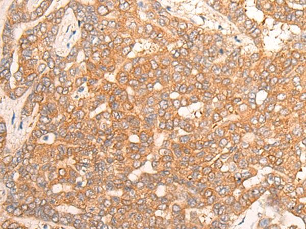 CPS1 Antibody