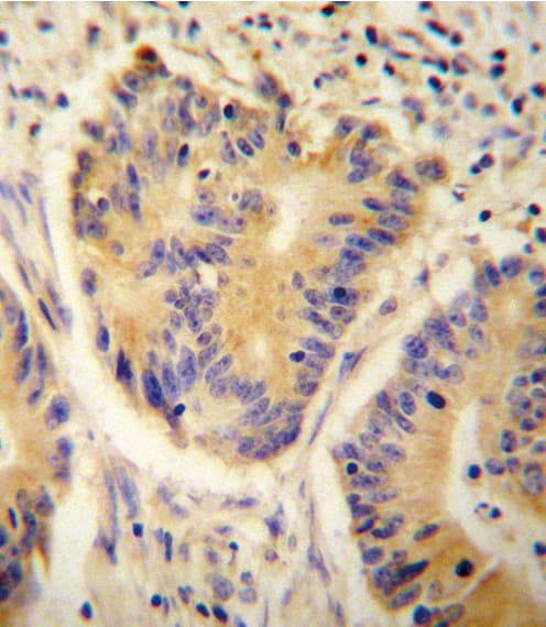 ADH4 Antibody (aa319-348)