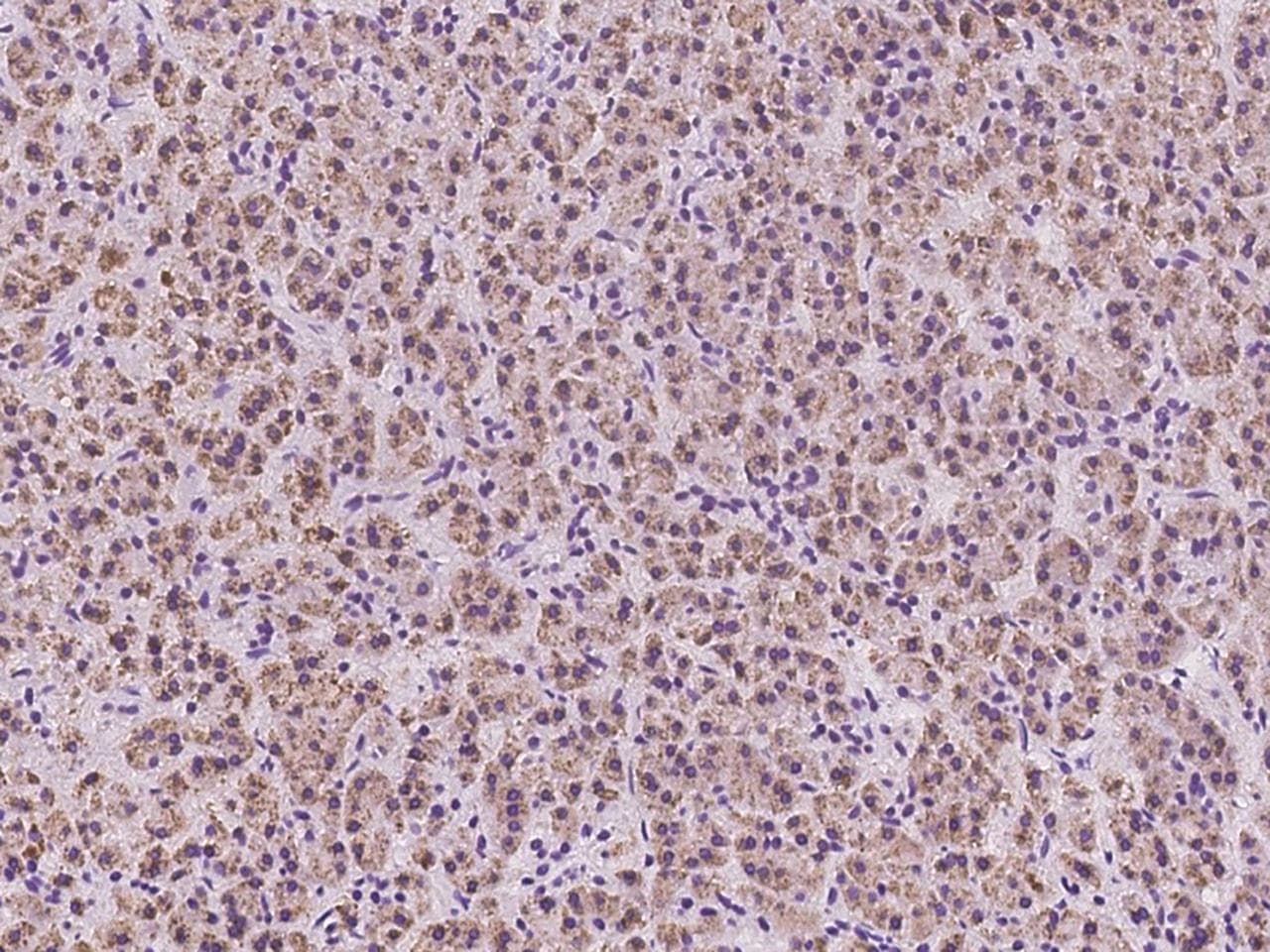 RIPK3 / RIP3 Antibody