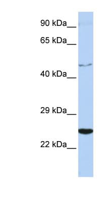 Polyclonal Rabbit anti-Human CRLF1 Antibody (aa252-301, WB)