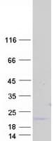 Human RNF185 Protein (Recombinant Myc-DDK (Flag))