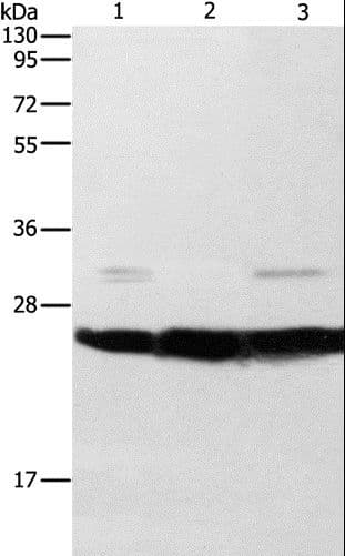 Polyclonal Rabbit anti-Human OPRS1 / SIGMAR1 Antibody (IHC, WB)