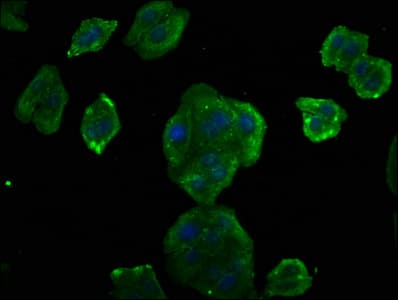 CCND2 / Cyclin D2 Antibody (aa1-289)