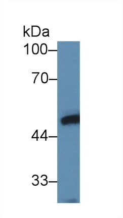 LYAR Antibody (aa270-388, FITC)