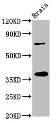 Polyclonal Rabbit anti-Human EIF3I / EIF3S2 Antibody (IHC, WB)