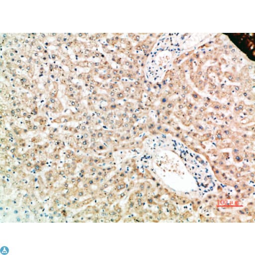 TNFRSF11A / RANK Antibody (aa60-120)