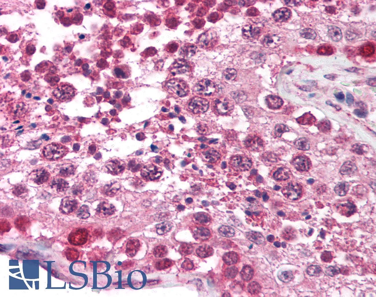 TRIM17 / RNF16 Antibody (aa254-303)