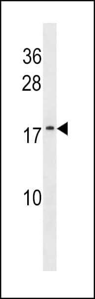 ATP5L2 Antibody (aa1-30)
