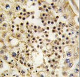 Monoclonal Mouse anti-Human LIN28A / LIN28 Antibody (clone 55CT58.12.1, IHC, IF, WB)