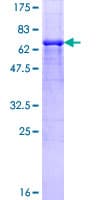 Human PHKG2 Protein (Recombinant GST)