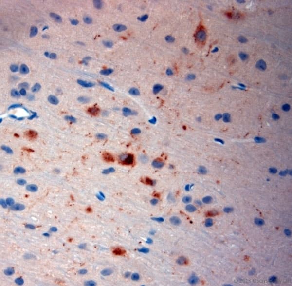 TACR1 / NK1R Antibody (aa150-200)