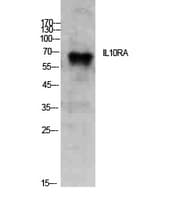 Polyclonal Rabbit anti-Human IL10RA Antibody (WB)
