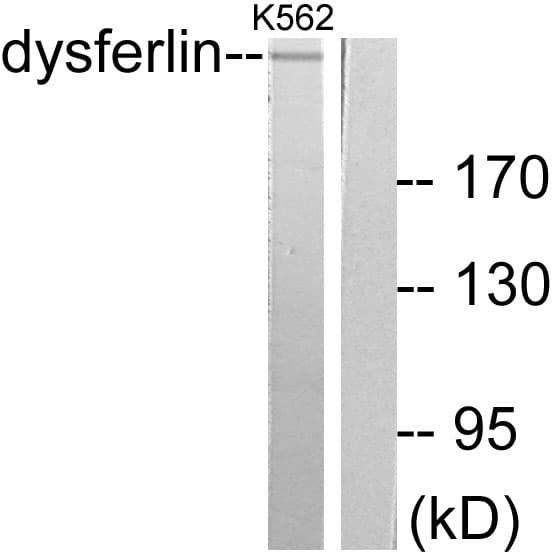 Dysferlin Antibody (aa1981-2030)