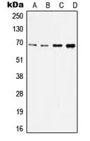 IRAK2 / IRAK-2 Antibody (Internal)