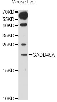 IHC-plus™ GADD45A / GADD45 Antibody